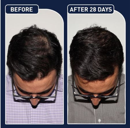 FEG Plus Hair Growth Serum and Spray 50ml