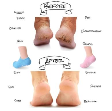 Reusable Silicone Spa Gel Moisturizing Socks for Dry Feet & Cracked Heels
