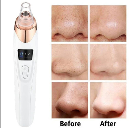 Rechargeable 5-in-1 Blackhead Remover Machine | Pore Vacuum & Acne Extractor